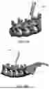Fig. 23 - DEVICES AND METHODS FOR SPINAL IMPLANT REMOVAL