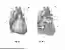Fig. 02 - MULTIPLE ELECTRODE HEART VALVE SLITTING DEVICE