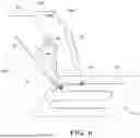 Fig. 07 - Techniques For Adaptive Reorientation Of A Robotic Surgical Tool