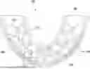 Fig. 01 - ORAL COMMISSURAL SPLINT