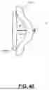 Fig. 35 - DEVICES, SYSTEMS, AND METHODS FOR MANIPULATING NASAL TISSUES