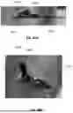Fig. 43 - DEVICES, SYSTEMS, AND METHODS FOR MANIPULATING NASAL TISSUES