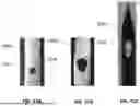 Fig. 46 - DEVICES, SYSTEMS, AND METHODS FOR MANIPULATING NASAL TISSUES