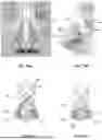 Fig. 53 - DEVICES, SYSTEMS, AND METHODS FOR MANIPULATING NASAL TISSUES