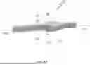 Fig. 63 - DEVICES, SYSTEMS, AND METHODS FOR MANIPULATING NASAL TISSUES
