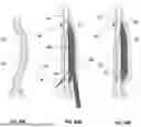 Fig. 65 - DEVICES, SYSTEMS, AND METHODS FOR MANIPULATING NASAL TISSUES