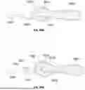 Fig. 76 - DEVICES, SYSTEMS, AND METHODS FOR MANIPULATING NASAL TISSUES
