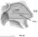 Fig. 89 - DEVICES, SYSTEMS, AND METHODS FOR MANIPULATING NASAL TISSUES