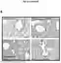 Fig. 09 - A COMPOSITION COMPRISING BLOOD PLASMA AND IMMUNOGLOBULINS FOR USE IN THE TREATMENT OR PREVENTION OF AN INFECTIOUS DISEASE