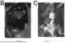 Fig. 14 - FISH LIVER DECELLULARIZED EXTRACELLULAR MATRIX BASED MICROFLUIDIC 3D PRINTING HYDROGEL, AND PREPARATION METHOD AND APPLICATION THEREOF