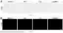 Fig. 17 - FISH LIVER DECELLULARIZED EXTRACELLULAR MATRIX BASED MICROFLUIDIC 3D PRINTING HYDROGEL, AND PREPARATION METHOD AND APPLICATION THEREOF