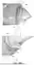 Fig. 167 - MASK ASSEMBLIES FOR RESPIRATORY THERAPY