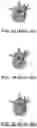 Fig. 02 - SYSTEMS AND METHODS FOR ASSISTING A SURGEON AND PRODUCING PATIENT-SPECIFIC MEDICAL DEVICES
