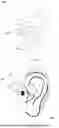 Fig. 02 - OPEN EARPHONES