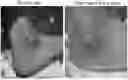 Fig. 01 - METHOD OF TREATING GOUT BY TOPICAL APPLICATION OF NANO LINIMENT