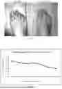 Fig. 13 - METHOD OF TREATING GOUT BY TOPICAL APPLICATION OF NANO LINIMENT