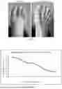 Fig. 14 - METHOD OF TREATING GOUT BY TOPICAL APPLICATION OF NANO LINIMENT