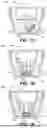 Fig. 03 - ZERO-EXPOSURE FORMALIN PREFILLED CONTAINER