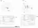 Fig. 08 - SYSTEMS AND METHODS FOR MULTI-STAGE SEARCH AND DISTANCE APPROXIMATION IN HIGH-DIMENSIONAL FEATURE VECTOR SPACES