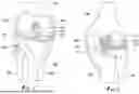 Fig. 02 - METHODS AND SYSTEMS FOR REGISTERING INTERNAL AND EXTERNAL COORDINATE SYSTEMS FOR SURGICAL GUIDANCE