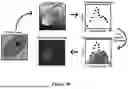 Fig. 05 - Order-based Diagnosis of Cervical Cancers