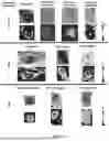 Fig. 09 - Order-based Diagnosis of Cervical Cancers