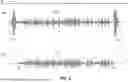 Fig. 03 - Proximity Muting for Microphone