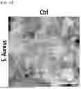 Fig. 52 - STRETCHABLE SEMICONDUCTOR FILM WITH BIOCOMPATIBILITY AND BIO-IMPLANTABLE ELECTRONIC DEVICE USING THE SAME