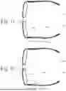 Fig. 07 - EEG Glasses (Electroencephalographic Eyewear)