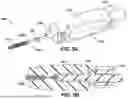 Fig. 07 - METHODS AND DEVICES FOR SEMI-RIGID BONE FIXATION