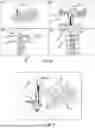 Fig. 07 - Method and System for Associating Pre-Operative Plan with Position Data of Surgical Instrument
