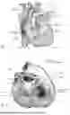 Fig. 02 - PROSTHETIC CARDIAC VALVE DEVICES, SYSTEMS, AND METHODS