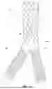 Fig. 02 - APPARATUSES AND METHODS FOR EXPANDABLE  BRANCHING STENT PROSTHESES