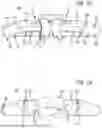 Fig. 02 - Frontal Supportive Orthosis