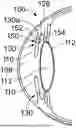 Fig. 01 - INTRAOCULAR IMPLANTS AND METHODS FOR IMPLANTING INTRAOCULAR IMPLANTS