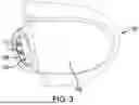 Fig. 04 - DEVICE AND METHOD FOR OPENING AN AIRWAY