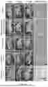 Fig. 17 - FLUORESCENT COMPOUNDS FOR ACCELERATED CANCER THERANOSTIC