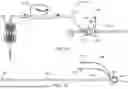 Fig. 04 - ASPIRATION CATHETER SYSTEMS