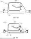 Fig. 06 - ASPIRATION CATHETER SYSTEMS