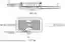 Fig. 10 - ASPIRATION CATHETER SYSTEMS