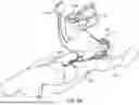 Fig. 13 - ASPIRATION CATHETER SYSTEMS