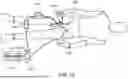 Fig. 16 - ASPIRATION CATHETER SYSTEMS
