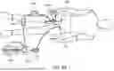 Fig. 18 - ASPIRATION CATHETER SYSTEMS