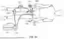 Fig. 20 - ASPIRATION CATHETER SYSTEMS
