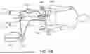 Fig. 24 - ASPIRATION CATHETER SYSTEMS