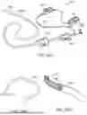 Fig. 36 - ASPIRATION CATHETER SYSTEMS