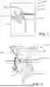 Fig. 02 - CPAP Bracket Device