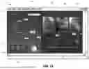 Fig. 02 - THREE-DIMENSIONAL SIZING TOOL FOR CARDIAC ASSESSMENT