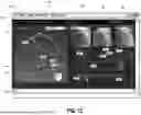 Fig. 04 - THREE-DIMENSIONAL SIZING TOOL FOR CARDIAC ASSESSMENT