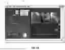 Fig. 09 - THREE-DIMENSIONAL SIZING TOOL FOR CARDIAC ASSESSMENT